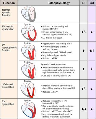 Sepsis-Induced myocardial dysfunction: heterogeneity of functional effects and clinical significance